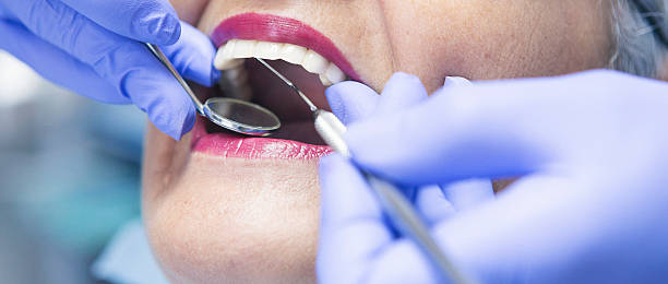 Best Emergency Treatment for Dental Infections or Abscesses in Reno, NV